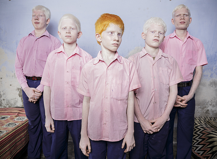 World Press Photo 2014: © Brent Stirton, South Africa, Reportage by Getty Images. Blind and Albino children in West Bengal in India. Raised in a school for underprivileged individuals,  these children are often forced to beg on the streets.